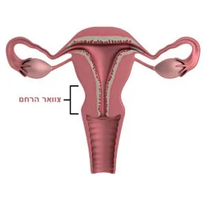 צוואר הרחם