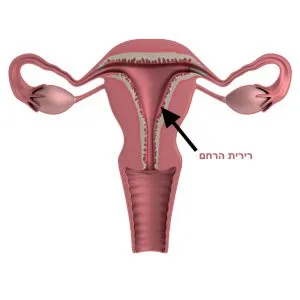 מהי רירית הרחם?