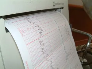 מוניטור עוברי לקראת לידה
