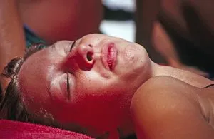 מניעת כוויות מהשמש
